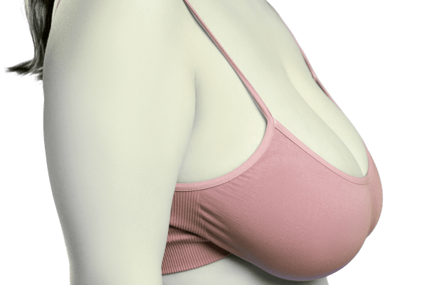 Breast Reduction Recovery Time: Week-by-Week Timeline | Harley Street Surgeon